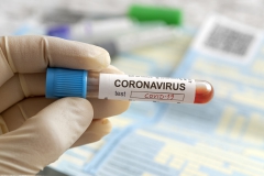 Medewerkers kinderopvang voorrang bij testen op corona Medewerkers kinderopvang voorrang bij testen op corona