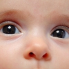 Afwijkende pupilreflex bij autisme Afwijkende pupilreflex bij autisme