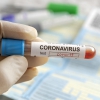 Coronatests: kinderopvang neemt heft in eigen handen Coronatests: kinderopvang neemt heft in eigen handen