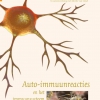 Een verrassende kijk op Auto-immuunreacties